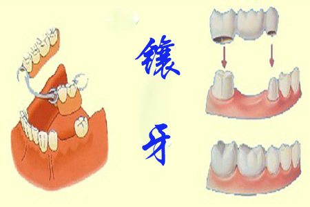图片15.png