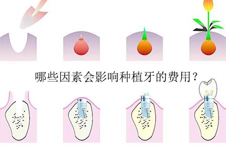1521100964265445.jpg 2.jpg