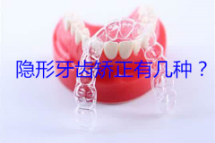 隐形牙齿矫正有几种？牙齿不齐的危害？