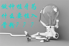 做种植牙为什么要植入骨粉？