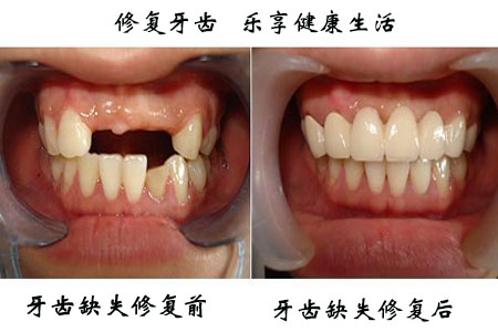 1526290537959796.png 图片11.png