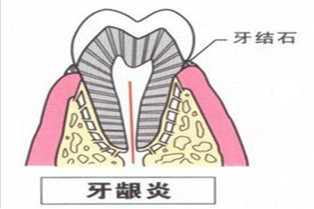 1524211502133510.png 图片5.png