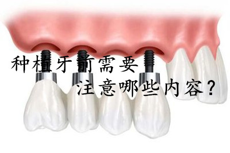 1524123509686277.png 图片7.png