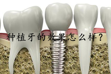 1524041803933248.png 图片1.png