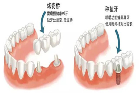 1524041817766737.png 图片3.png