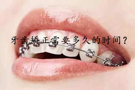 图片22.png