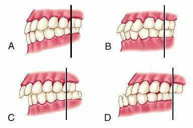 1526371390753330.jpg timg (3).jpg