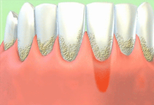 1527565519734508.gif timg.gif