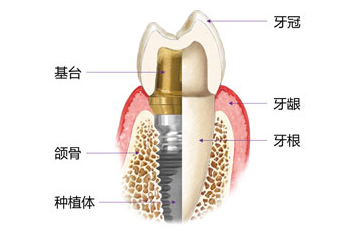 1529482308645220.png QQ图片20180620160829.png