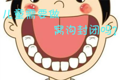 福州儿童需要做窝沟封闭吗？窝沟封闭价格贵吗