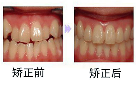1586657289938570.png 图片 3.png