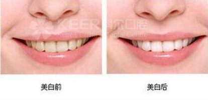 1586309557336917.png 图片1388.png