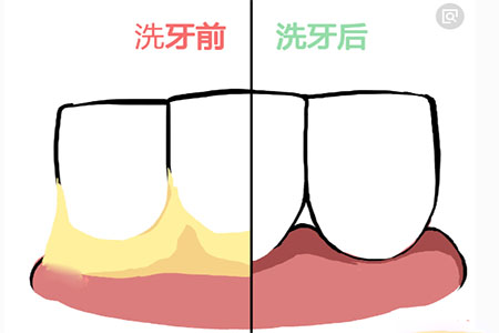 图片18.png
