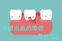 福州牙龈出血的原因是什么？