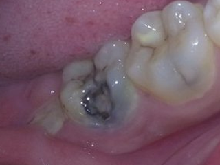 图片17.png