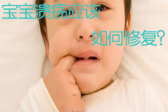 福州宝宝溃疡应该如何修复？