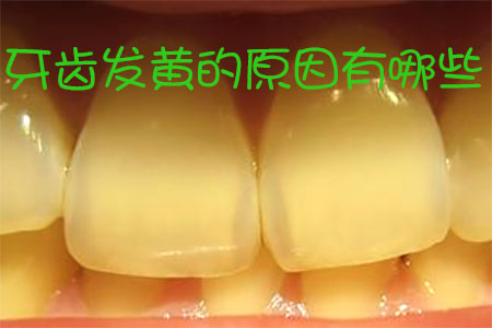 图片22.png