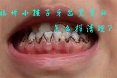 福州小孩子牙齿黑黑的怎么样清理？