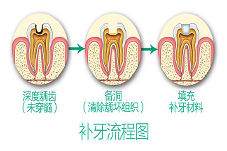 图片17.png
