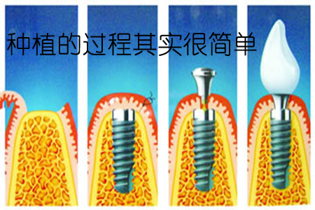 图片 1.png